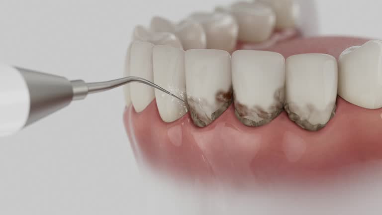 Trusted Emergency Dentist service in Versailles, OH - Dentist Open Now